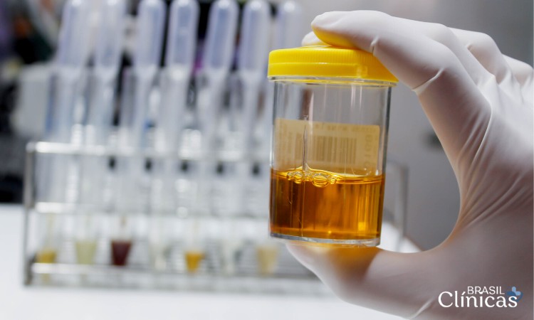 exame-de-urina-detecta-quais-doencas - Brasil Clínicas